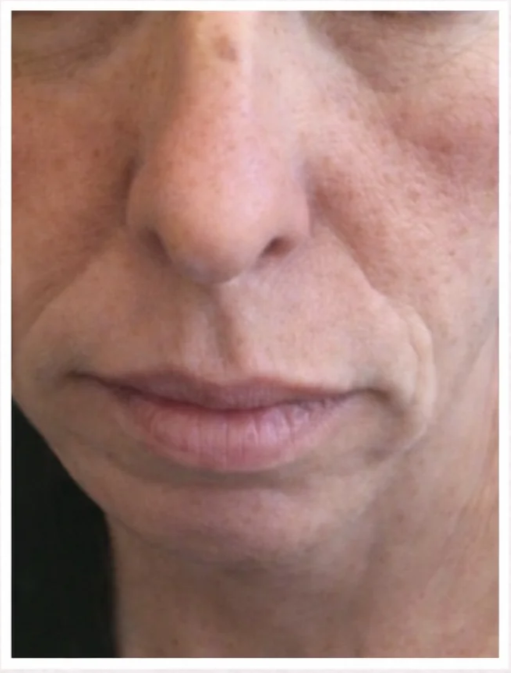 Customer result before