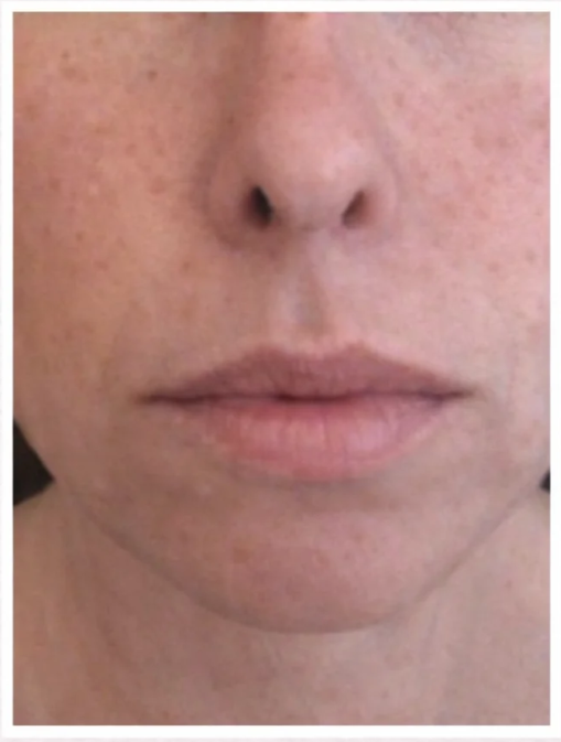 Customer result after