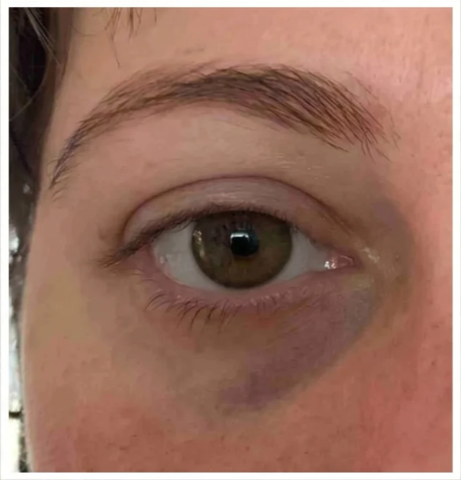 Customer result before