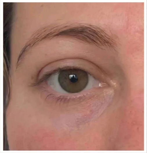 Customer result after